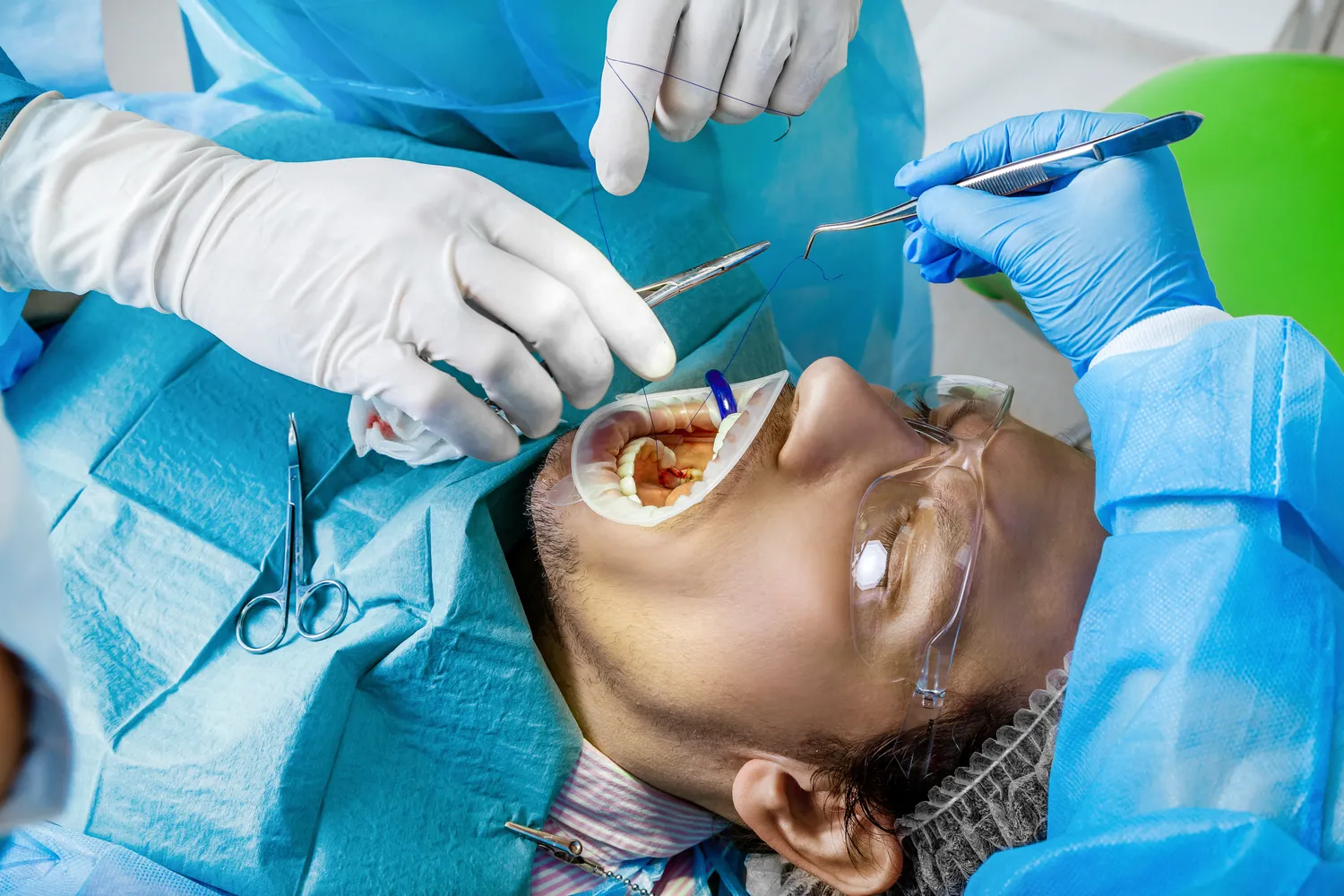 Ile kosztują implanty zębów w Turcji?