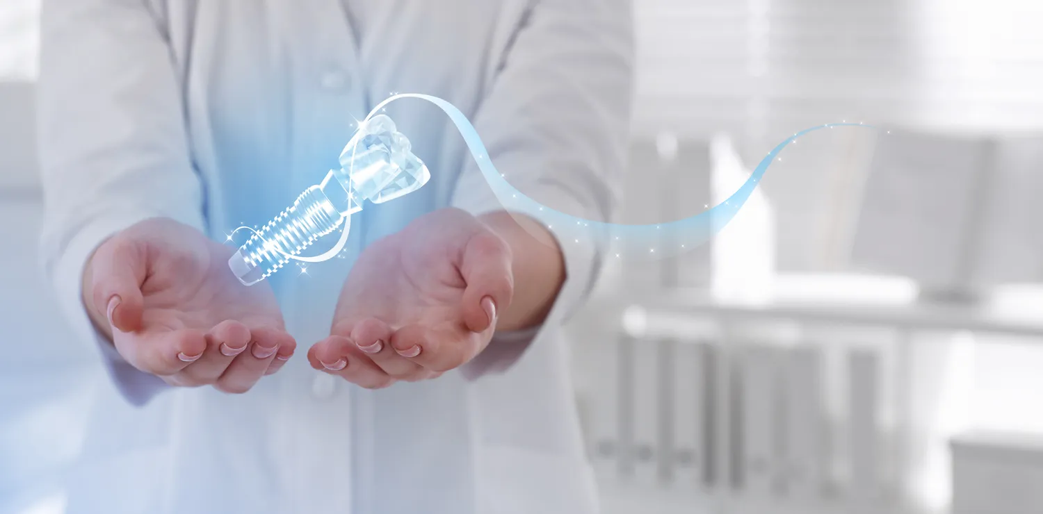 Bezśrubowe implanty zębów co to znaczy?